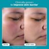 Clear, Smooth Skin with Paula’s Choice BHA Exfoliant