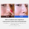 Medicube Zero Pore Pads - Dual-Textured Exfoliating and Pore-Tightening Toner Pads