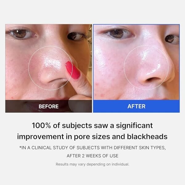 Medicube Zero Pore Pads - Dual-Textured Exfoliating and Pore-Tightening Toner Pads