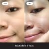 Mighty Patch™ Original Acne Pimple Treatment